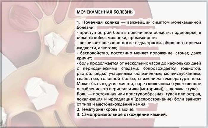 Служба в тюрьме с камнями в почках